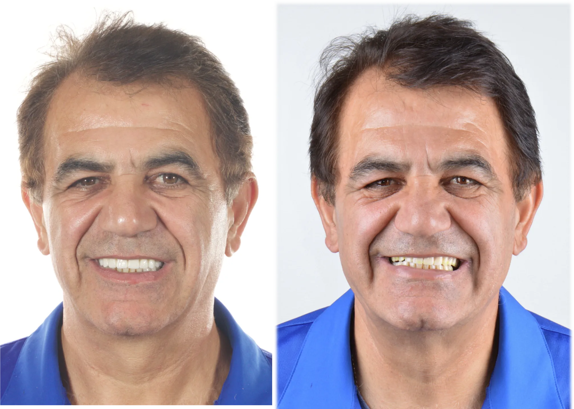 Smile gallery showcase