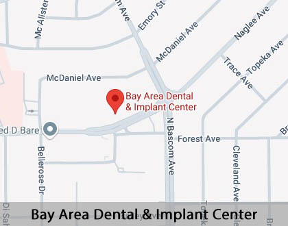 Map image for Root Scaling and Planing in San Jose, CA